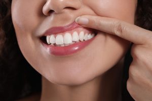 young woman showing her teeth and gums for checkup