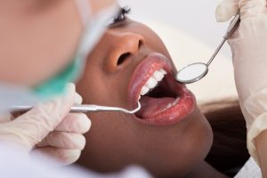 dental cleanings in Deer Park, TX