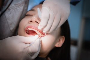 dental checkups near you