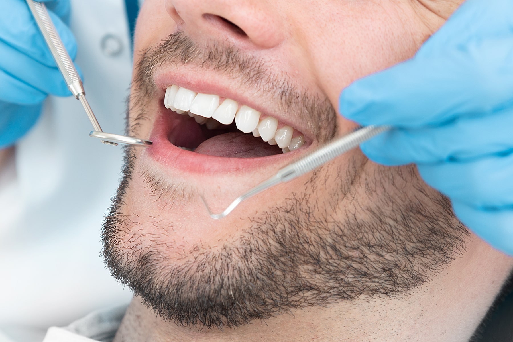 Man at general dental appointment in Deer Park, TX