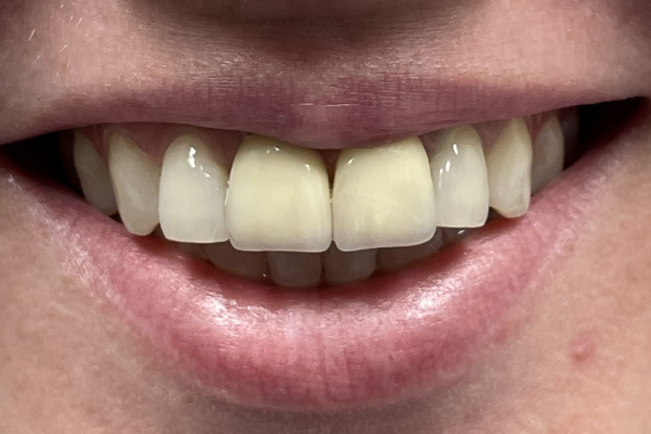 Before image