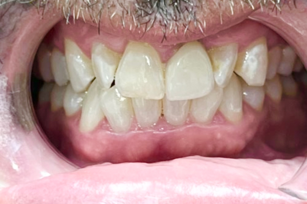 Before image